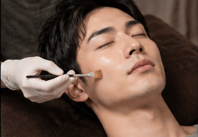 薬剤を肌に塗布するピーリング施術