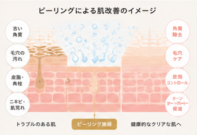 ピーリングによる肌改善のイメージ